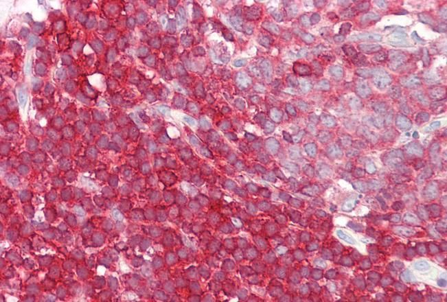 Goat anti-LSP1 Antibody