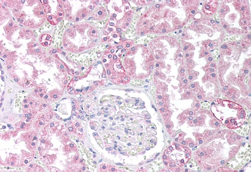 PPP2CA / PPP2CB antibody