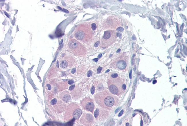Goat anti-PRKAB2 Antibody