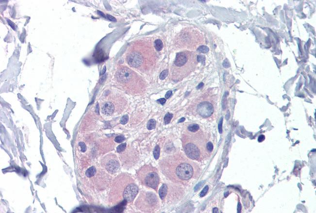 PRKAB2 antibody