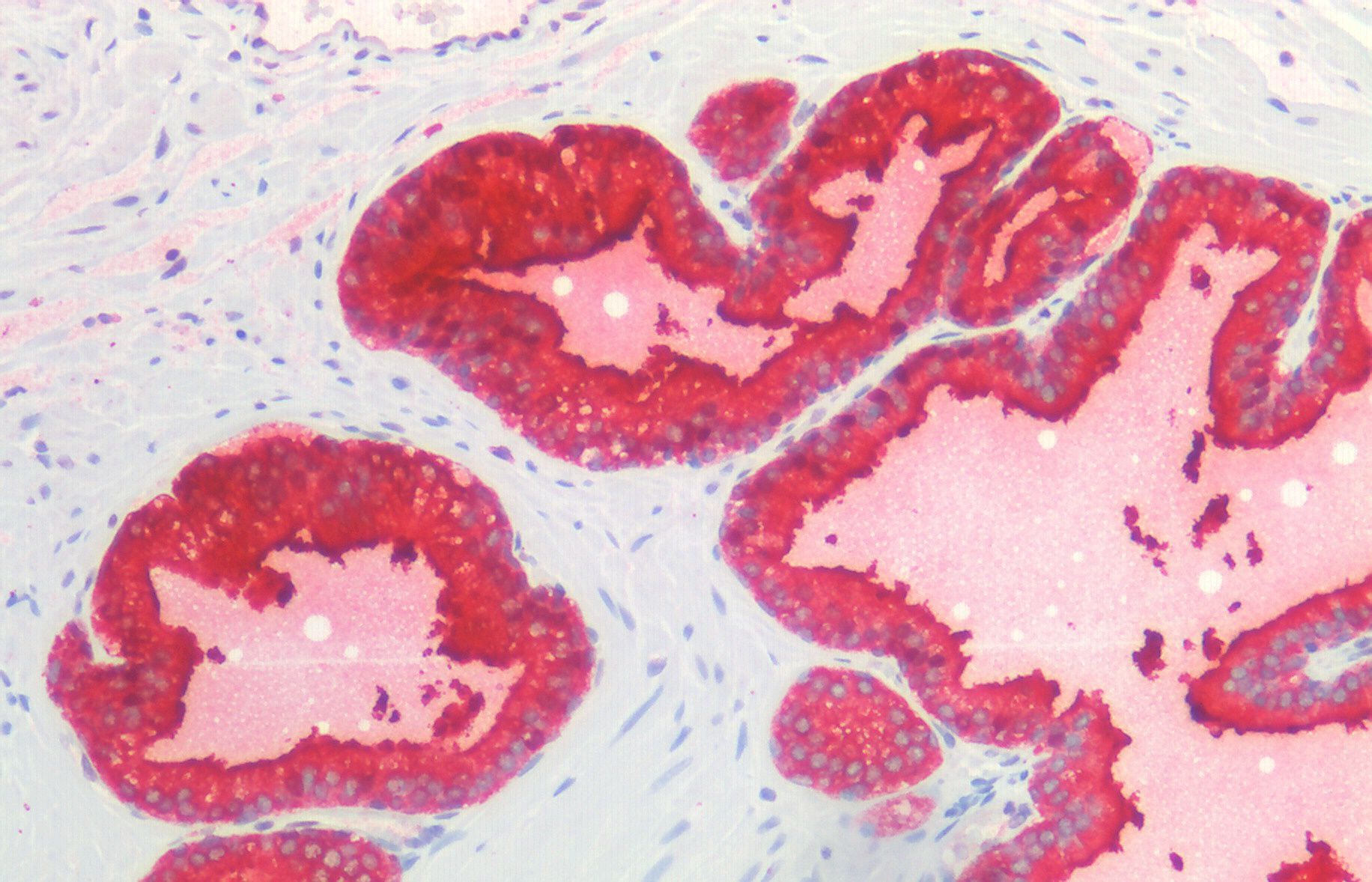 Goat anti-PSA (isoform 1) / KLK3 Antibody