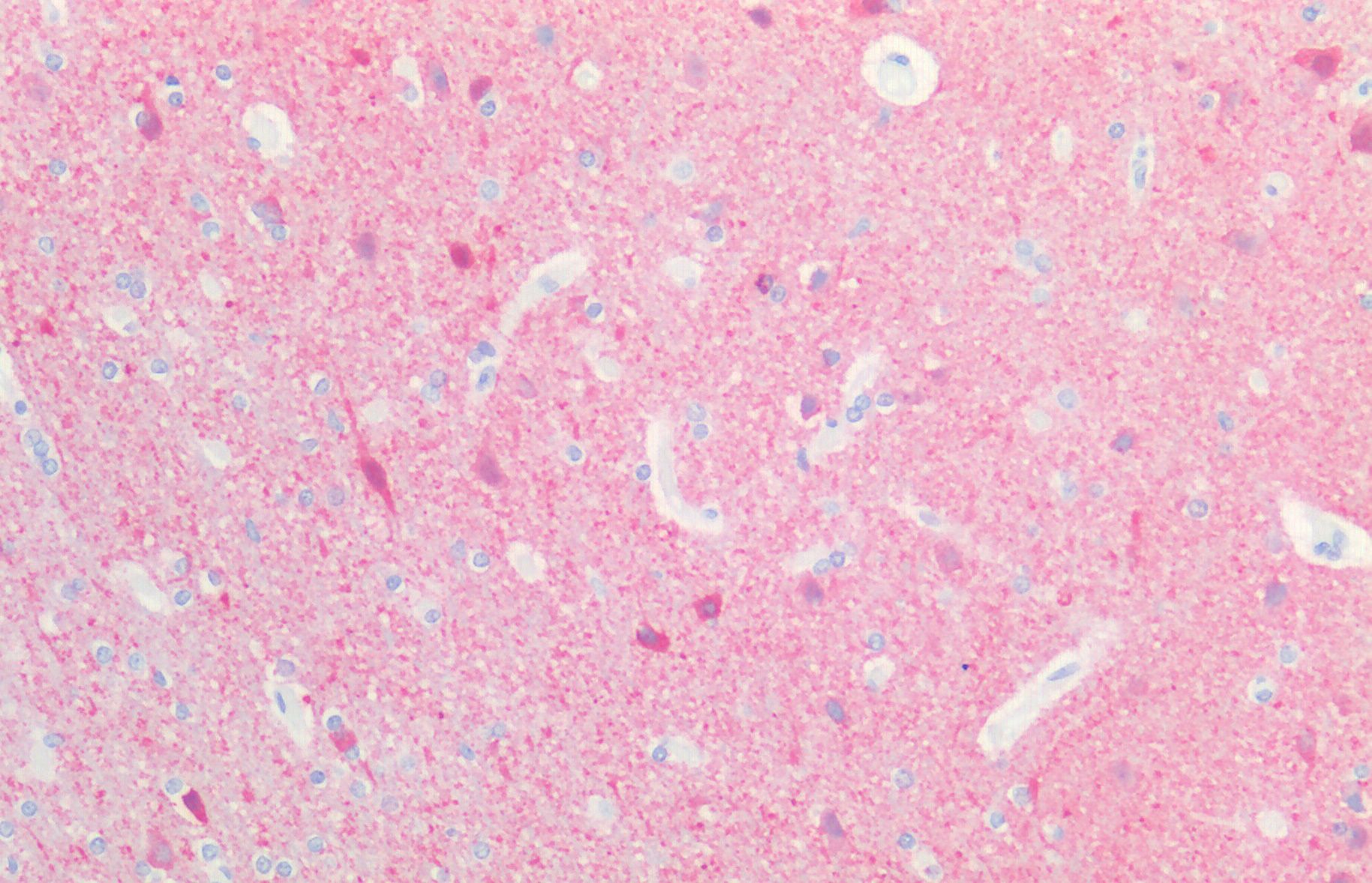 Goat anti-UCHL1 (aa 58-68) Antibody
