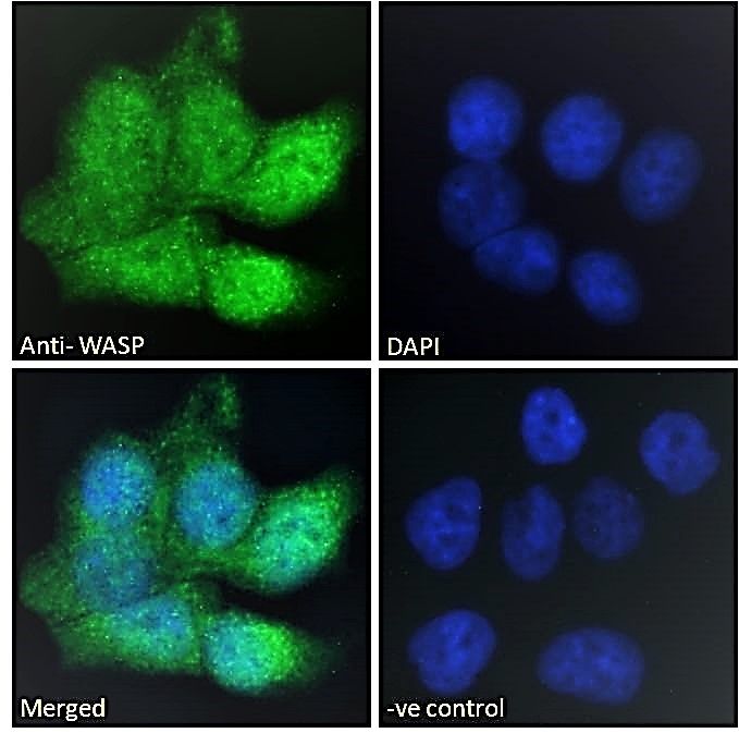 Goat anti-Wiskott-Aldrich Syndrome / WASP Antibody