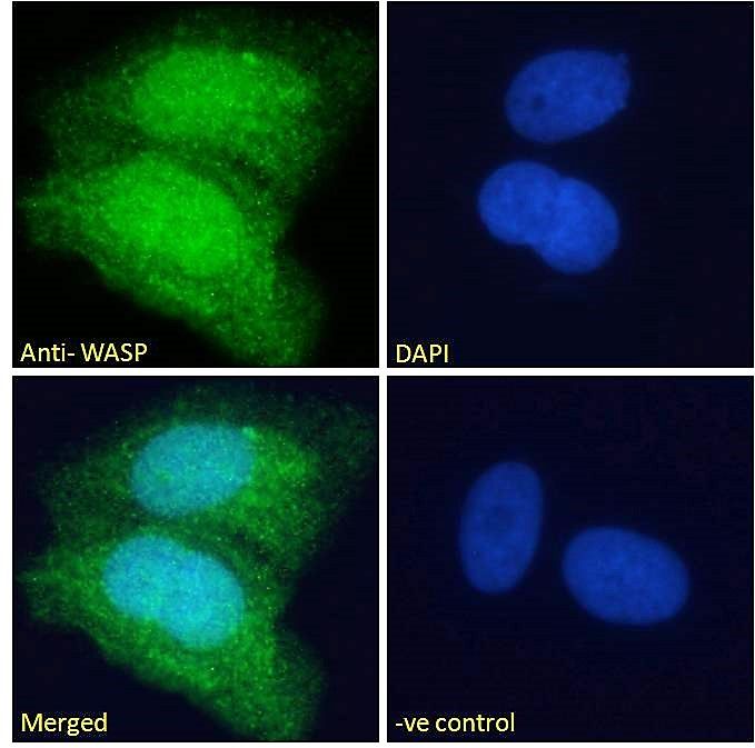 Goat anti-Wiskott-Aldrich Syndrome / WASP Antibody