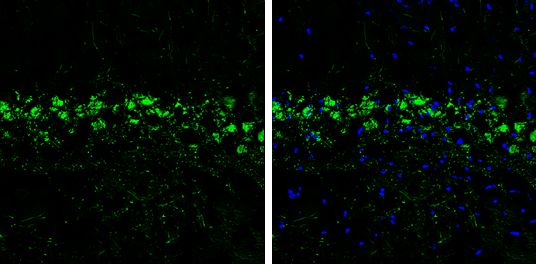 proDynorphin antibody