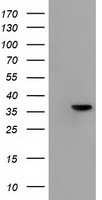 PFN1 Antibody