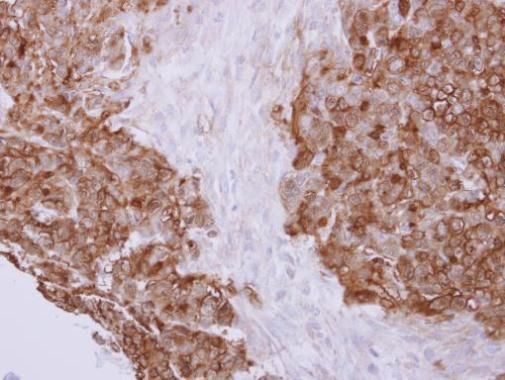 Profilin 2 antibody