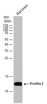 Profilin 2 antibody