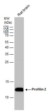 profilin 2 Antibody