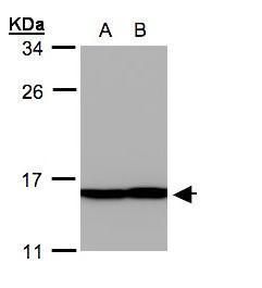 profilin 2 Antibody