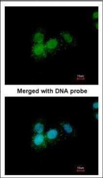 Progesterone Receptor Rabbit Polyclonal Antibody