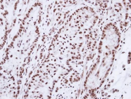 Progesterone Receptor Rabbit Polyclonal Antibody