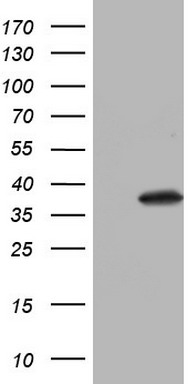 PGR Antibody