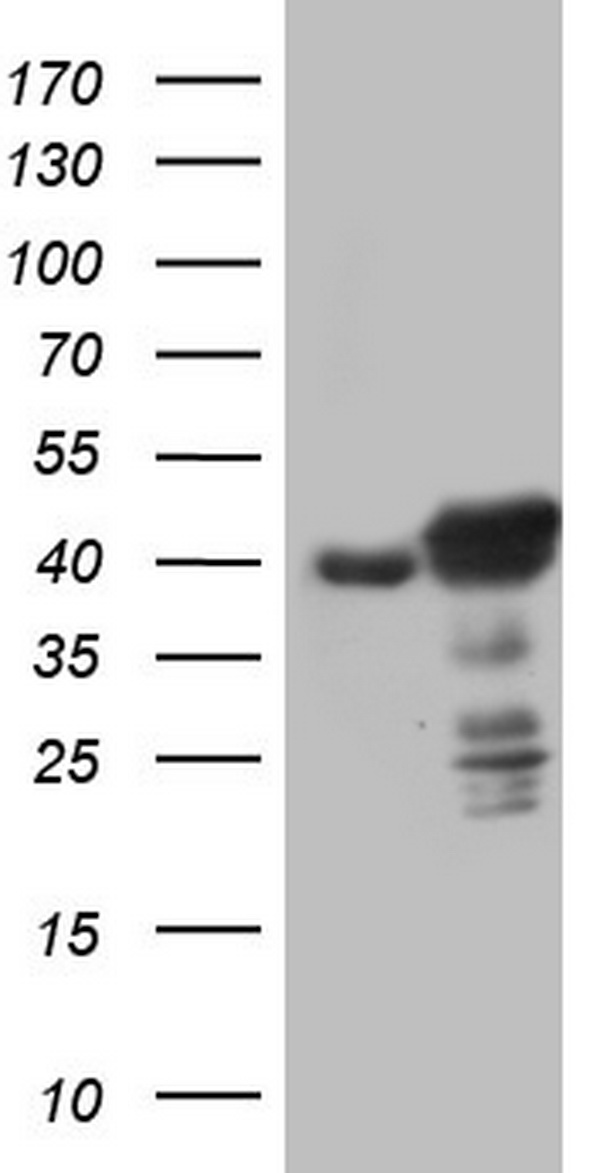 Progesterone Receptor Antibody