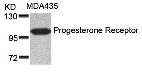 Progesterone Receptor (Ab90) Antibody
