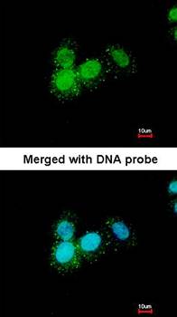 Progesterone receptor antibody