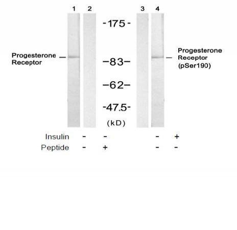 Progesterone Receptor (Phospho-Ser190) Antibody