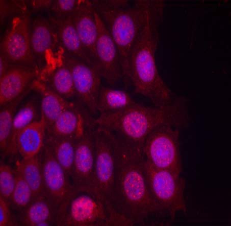 Progesterone Receptor (Phospho-Ser190) Antibody