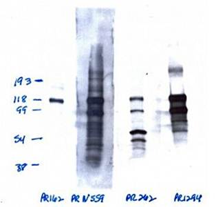 Progesterone Receptor Monoclonal Antibody (Phospho S162) [1064/E2] - 50ul