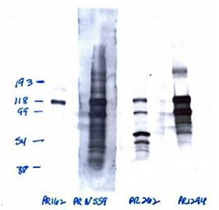 Progesterone Receptor Monoclonal Antibody (Phospho S162) [1064/E2] - 0.1ml