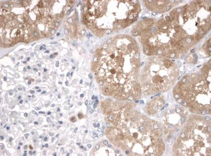 Rabbit Human Programmed cell death protein 1 Antibody