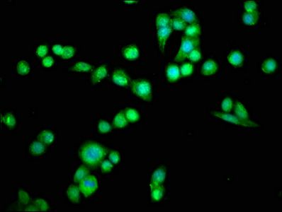 Programmed cell death protein 6 antibody