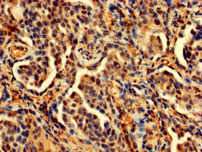PDCD6 Antibody
