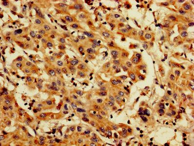 PDCD6 Antibody