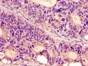 PROKR2 Antibody