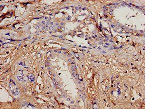 PIP Antibody