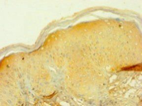PIP Antibody