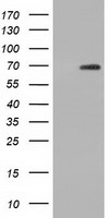 Prolactin Antibody