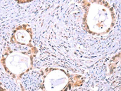 PROS1 Antibody