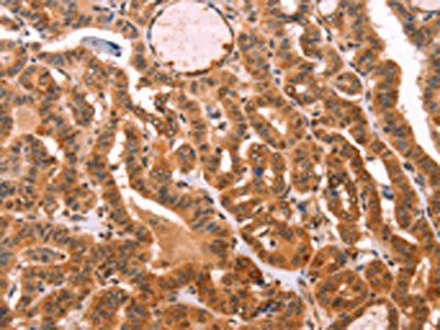 PROS1 Antibody