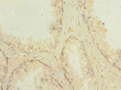 PLPBP Antibody