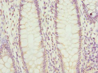 Prostaglandin E synthase 2 antibody