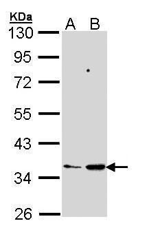 MGAT3 antibody