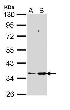 MGAT3 antibody [N3C3]