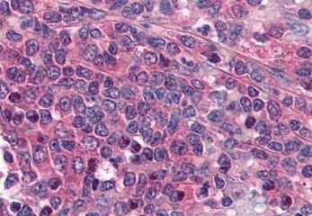 Goat anti-EP1 receptor / PTGER1 Antibody