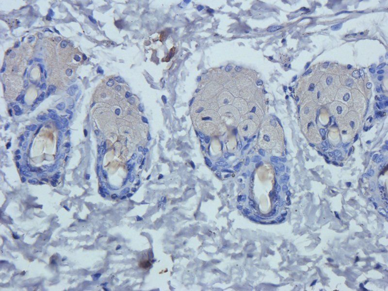 Prostaglandin E synthase 2 antibody