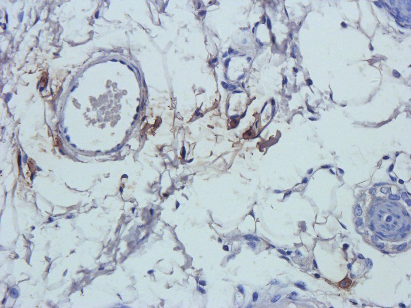 Prostaglandin E synthase 2 antibody