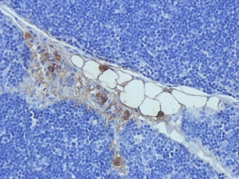 Prostaglandin E synthase 2 antibody