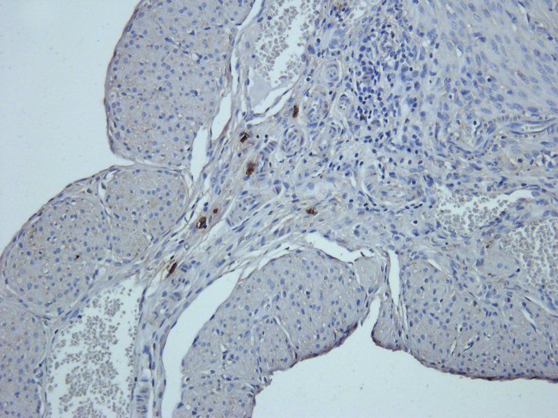 Prostaglandin E synthase 2 antibody