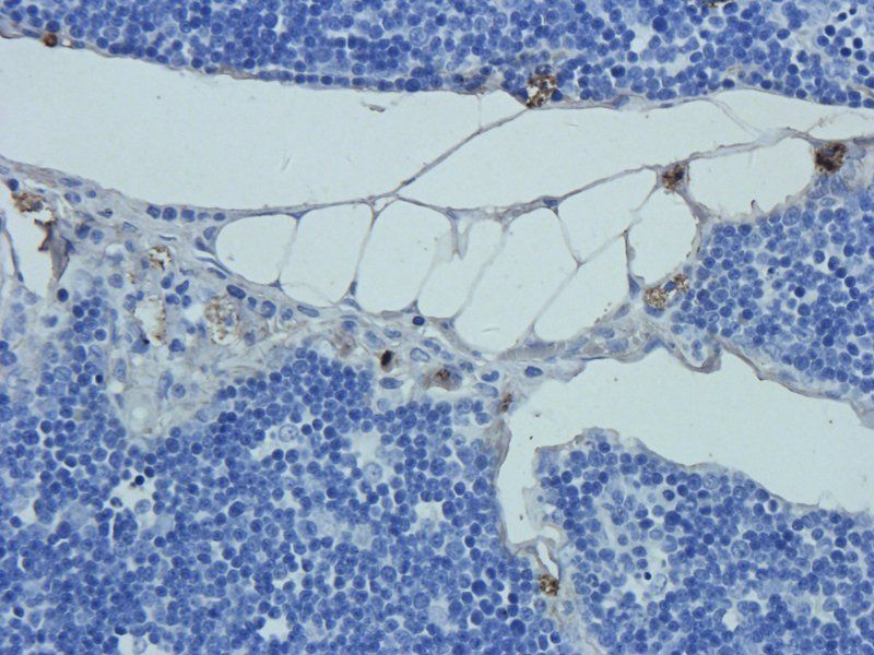 Prostaglandin E synthase 2 antibody