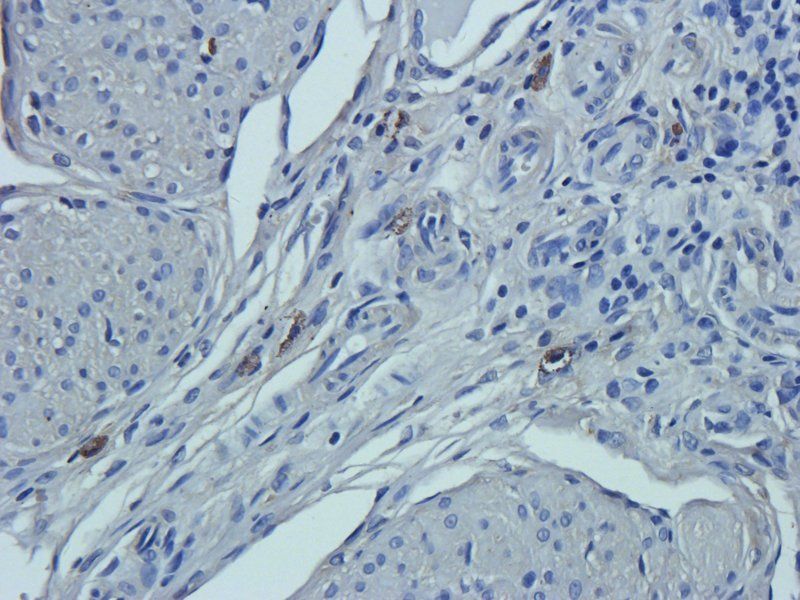 Prostaglandin E synthase 2 antibody