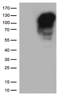 Prostate Specific Antigen (KLK3) Mouse Monoclonal Antibody