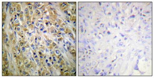 Prostate-specific Antigen Antibody