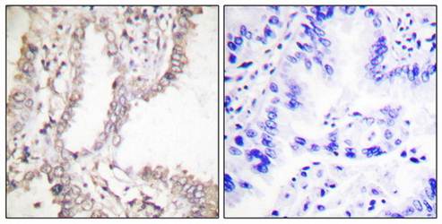 Prostate Apoptosis Response protein-4 Antibody