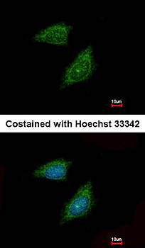 Protease Inhibitor 15 antibody