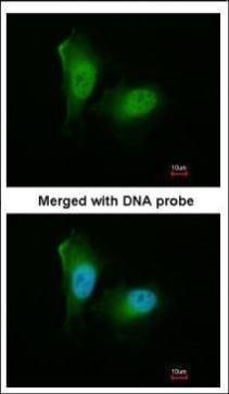 Proteasome 20S alpha 2 Rabbit Polyclonal Antibody